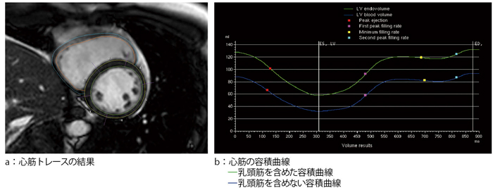 }2@S؂̃g[X SŐS؃g[XsC؂܂߂ʏ̉́ijƓ؂܂߂Ȃ́ij2ނ̉͌ʂB