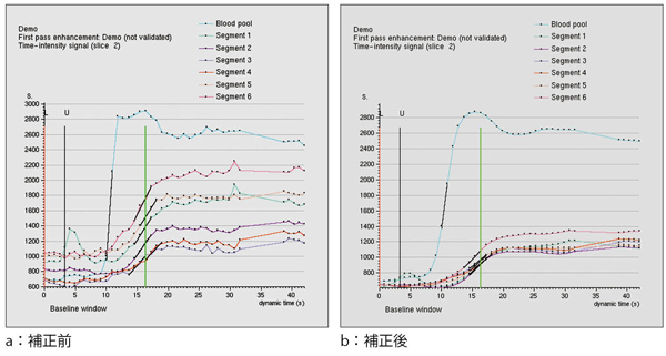 }3@pt[W͂ɂ␳ [VRNV@\Cx[XCRNV@\𕹗p邱ƂŁCċzϓZOgԂ̐M␳Cx̍͂ĂB