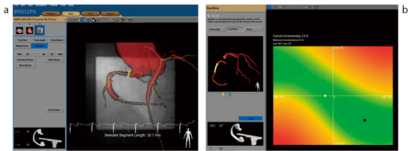 }3@CTO Navigator aFSǕaϕ̃[gSCTɂčČB bFOptimal View Map@\Bǂ̒dȂ肩Cłώ@₷AOZoB