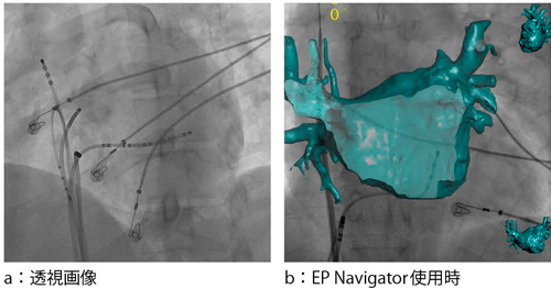 }4@EP Navigator EP Navigatorɂ鍶S[̓o\ɂCJe[eʒu̐mȔc\ƂȂB