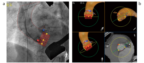 }6@Heart Navigator aF摜ɑ哮فCNnCΊDуfoCXdˍ킹B bFpOvjOB哮فCNnCΊDуfoCX𒊏o