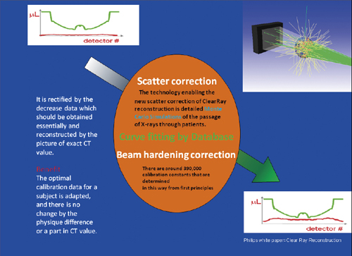 }1@Clear Ray Reconstruction̊TO}