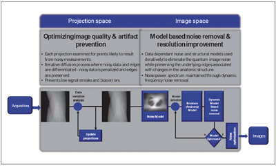 }2@iDose4 reconstructionTO}