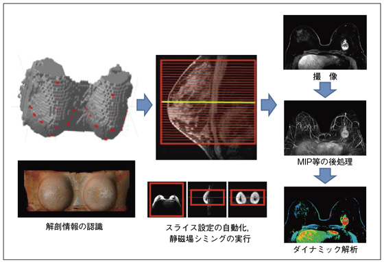 図1 Smart Exam Breastの概要