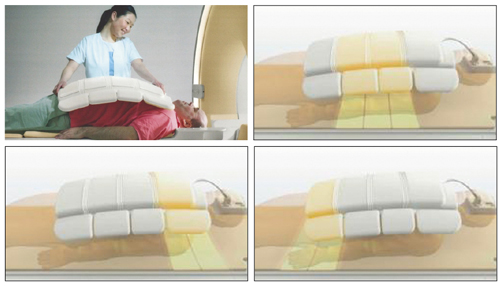 図4 Smart Selectの概念