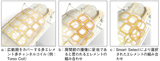 図5 Smart Selectによる肩関節の撮像の例(Torso Coil使用時の例)