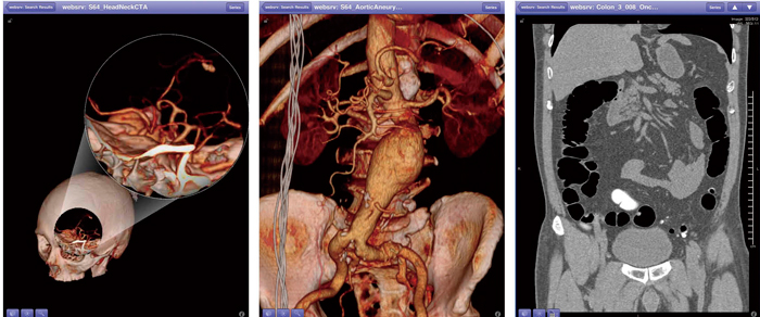 iPadiPhonepsyngo.via WebReport̉ʗB^b`ŒIɈC摜\Xs[h̃XgXȂB