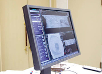 ACUSON S2000 ABVS̃[NXe[VłuABVS Workplacev