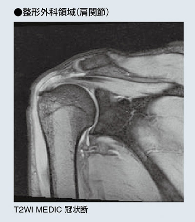 整形外科領域(肩関節)