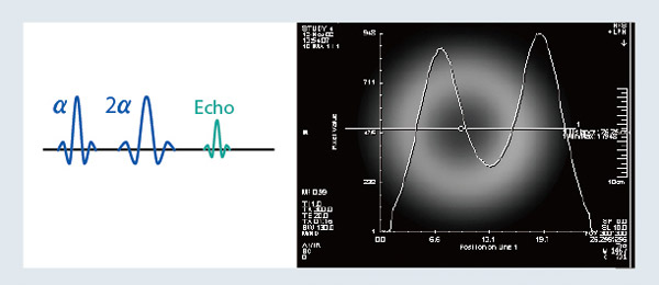 図3 a スピンエコーのRF分布( TR=300ms, α=90)