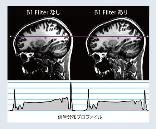 図5 B1 Filter の効果