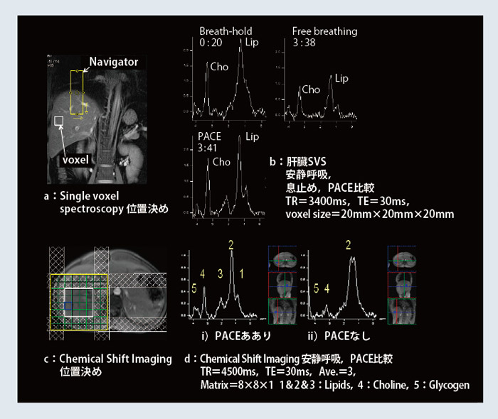 図3 2D PACE併用 Spectroscopy(W.I.P.)