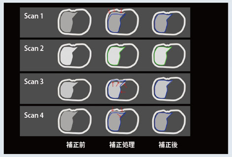 }6@DynaVIBEɂ̑摜̈ʒuY␳