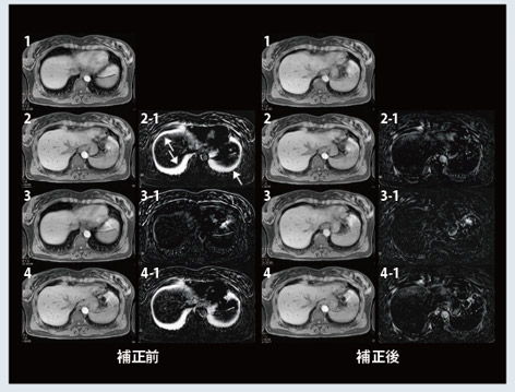 }6@DynaVIBEɂ̑摜̈ʒuY␳