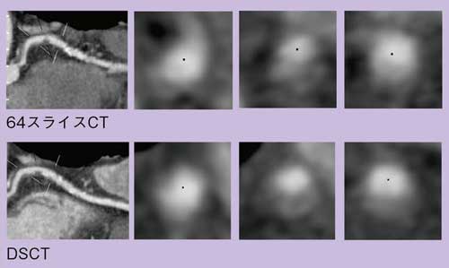 }3@Ǘɂ64XCXCTDSCT̊v[No\̔r