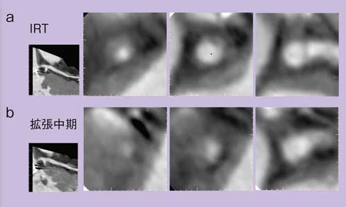 }5@DSCTɂ鍂SǗɂč\̈Ⴂɂ掿̕ω