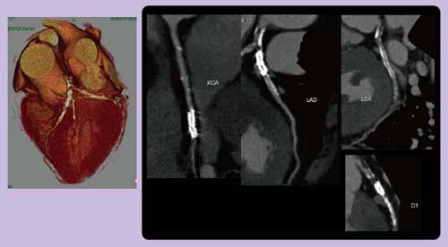 }2@Case 3F70΁CjC3}PCI