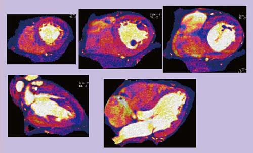 }3@}2̏ǗDEC[WOi[h}bvj