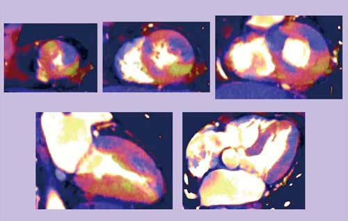 }4@Case 4F65΁CCJ쎞