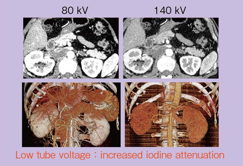 }1@80kVij140kViEjŎBe摜