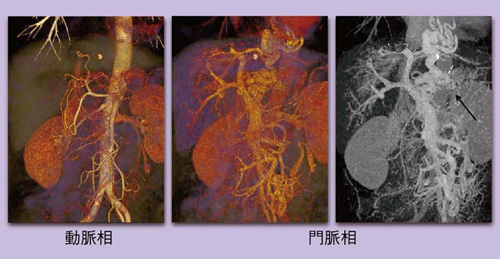 }4@DEC[WOɂݐÖᎂ̍CTACCTP摜