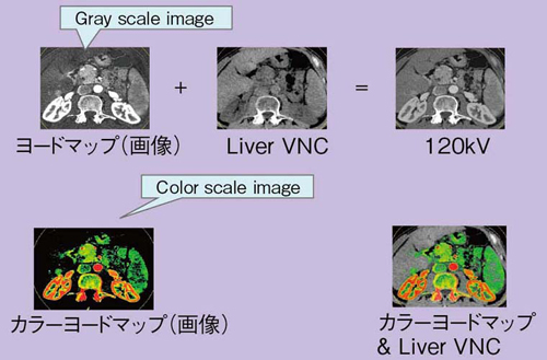 }6@Liver VNC̉pi̍זEj