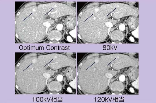 }8@Optimum ContrastƂ̑̉摜̔r