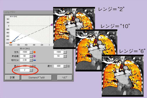}3@LungPBVAvP[Ṽp[^ݒ