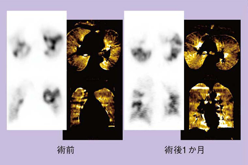 }8@Case3FCTEPH̏pOEp