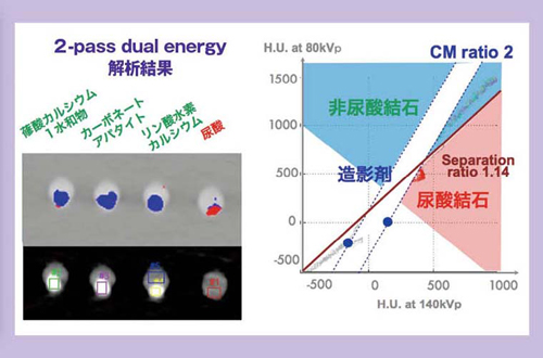 }7@2-pass dual energy͂̌