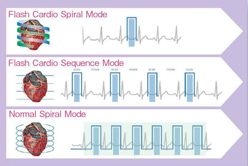 図1 冠動脈CTのスキャンモード