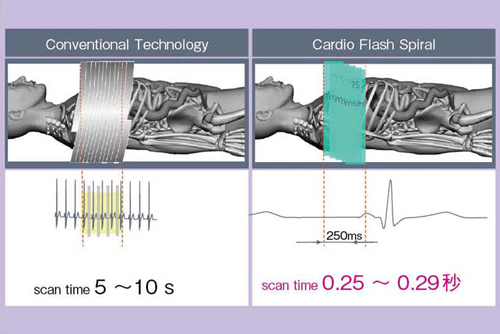 図2 Flash Cardio Spiral Mode