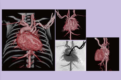 図7 2歳,男児,MAPCA(鎮静剤・息止めなし)