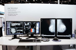 syngo MammoReport