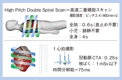 }1@High-Pitch Double Spiral ScanidXLj
