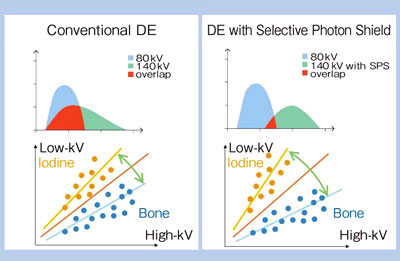 }4@Dual Energy ImagingFSelective Photon Shield
