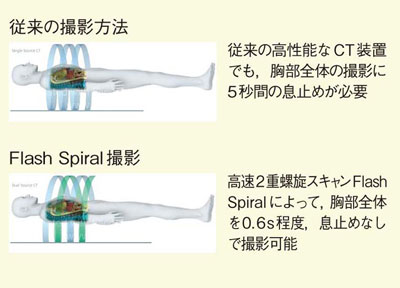 図1 High Pitch Double Spiral Scan