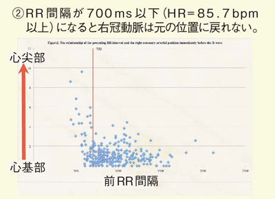 }2@ORRԊuRgỎËʒuiԃC700msj