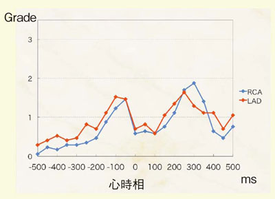 図3 4D cine画像による冠動脈描出能の評価 R波を中心に50msごとに再構成して4段階で評価した。青が右冠動脈,赤が左前下行枝。