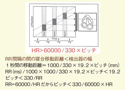 図4 ヘリカルピッチと寝台移動距離から最適な心拍数を求める計算式