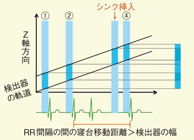 図5 心電図editを使ったデータ補完方法