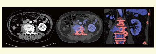}3@̍זEhard plaque摜