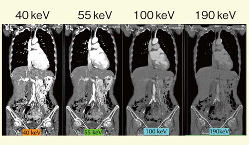 }7@monoenergetic image