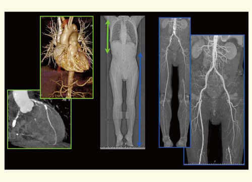 }9@Flash SpiralDual Energy̎g