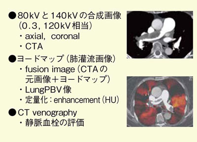 図1 DEイメージングによる肺血栓塞栓症の評価