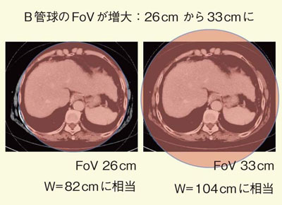 }1@DefinitionDefinition FlashFoV̈Ⴂ