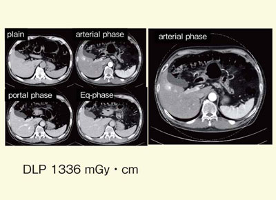 }2@AP shunt̏Ǘi68΁CjCC^̉j