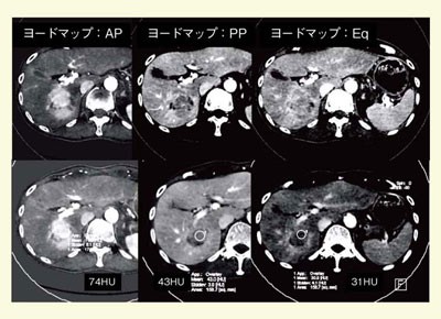 }7@[h}bvROIl̓[hʂ𔽉f