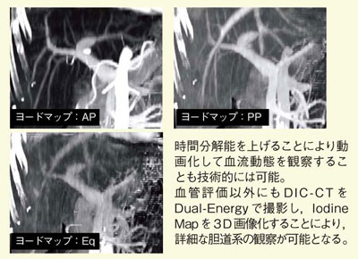 }9@[h}bv̉pFMIPɂCTA̍쐬