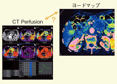 }10@qWIÂ̎Ìʔc[ƂẴ[h}bv̉p